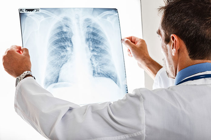 Różnice i podobieństwa w leczeniu zapalenia oskrzeli i zapalenia płuc