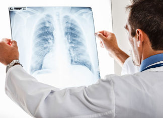Różnice i podobieństwa w leczeniu zapalenia oskrzeli i zapalenia płuc